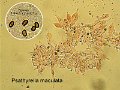 Psathyrella maculata-amf1605-micro